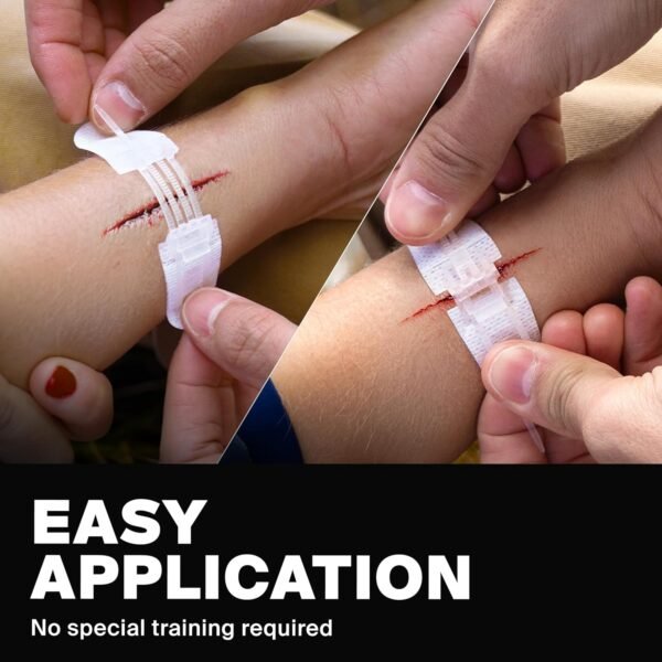 Zip Stitch Wound Closure Strips - Repair Wounds Wi... - Image 5