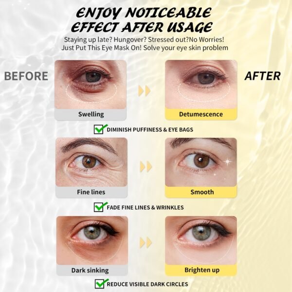 Under Eye Patches (25 Pairs), Caffeine Eye Masks f... - Image 4