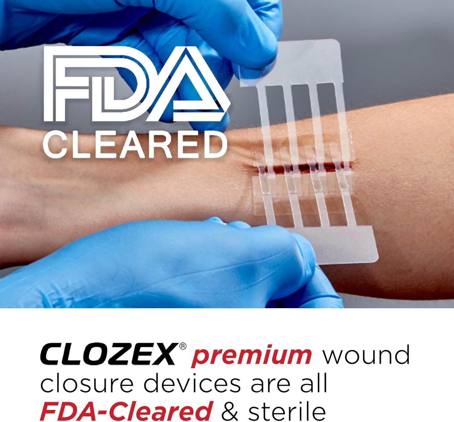 Clozex Emergency Laceration Closures - Repair Woun... - Image 4