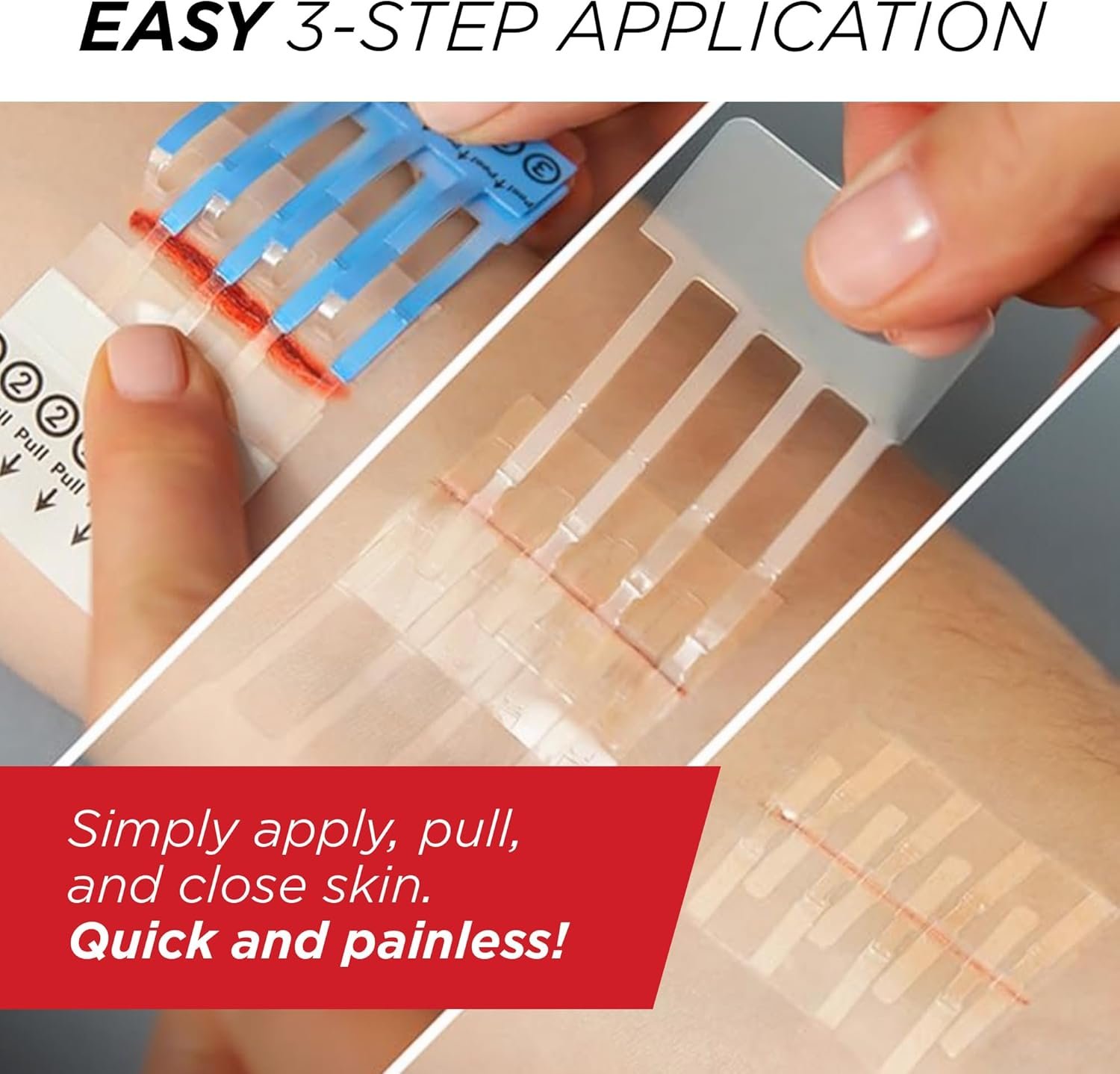 Clozex Emergency Laceration Closures - Repair Woun... - Image 6