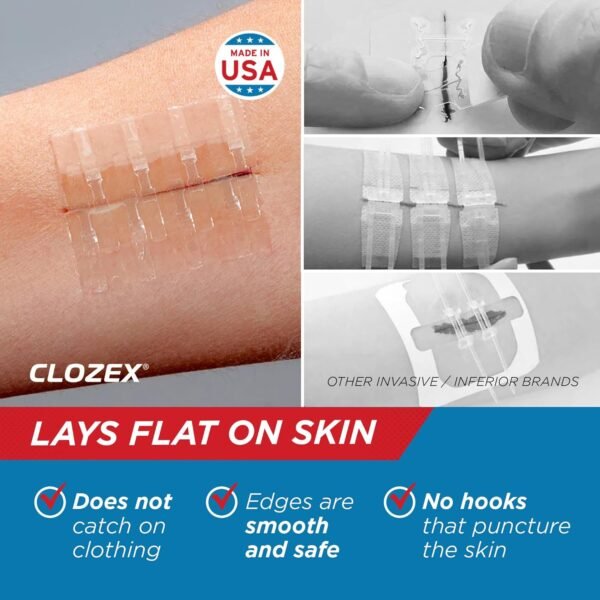 Clozex Emergency Laceration Closures - Repair Woun... - Image 5