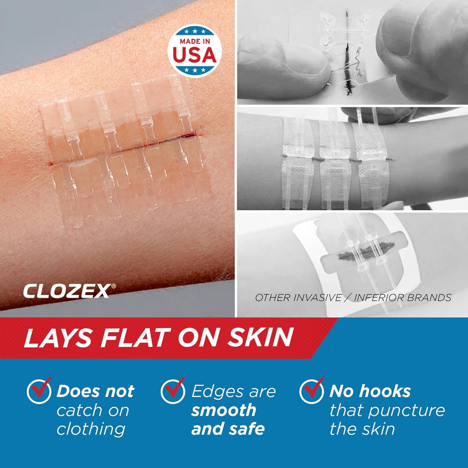 Clozex Emergency Laceration Closures - Repair Woun... - Image 5